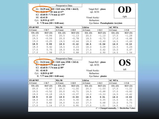 Lentes Intraoculares