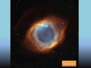 Lentes Intraoculares