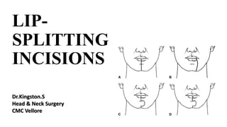 LIP-
SPLITTING
INCISIONS
Dr.Kingston.S
Head & Neck Surgery
CMC Vellore
 