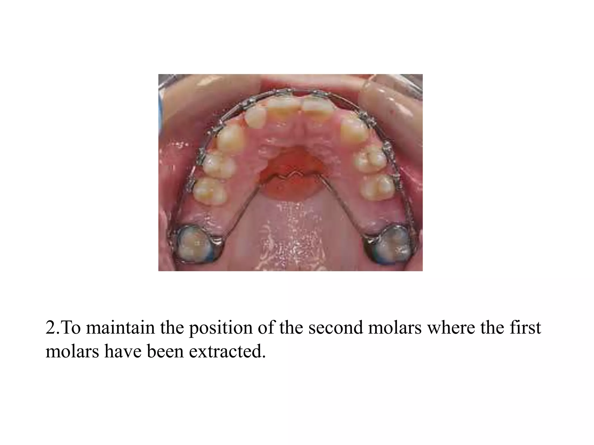 Quad helix seminar | PPTX