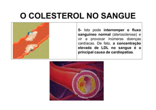 O COLESTEROL NO SANGUE
5- Isto pode interromper o fluxo
sanguíneo normal (aterosclerose) e
vir a provocar inúmeras doenças
cardíacas. De fato, a concentração
elevada de LDL no sangue é a
principal causa de cardiopatias.
 