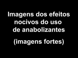 Imagens dos efeitos
  nocivos do uso 
  de anabolizantes
 (imagens fortes)
 