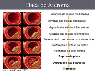Placa de Ateroma
            Acumulo de lipídios modificados

         Ativação das células endoteliais

          Migração das células inflamatórias

          Ativação das células inflamatórias

      Recrutamento das células musculares lisas

           Proliferação e síntese da matriz

              Formação da capa fibrosa

                  Ruptura da placa

             Agregação das plaquetas

                      Trombose
 