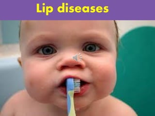 Lip diseases
 