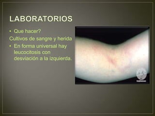 • Que hacer?
Cultivos de sangre y herida
• En forma universal hay
  leucocitosis con
  desviación a la izquierda.
 