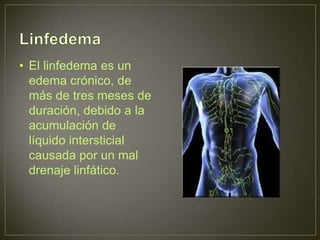 Linfangitis Reticular Lipedema, linfangitis, linfedema | PPTX