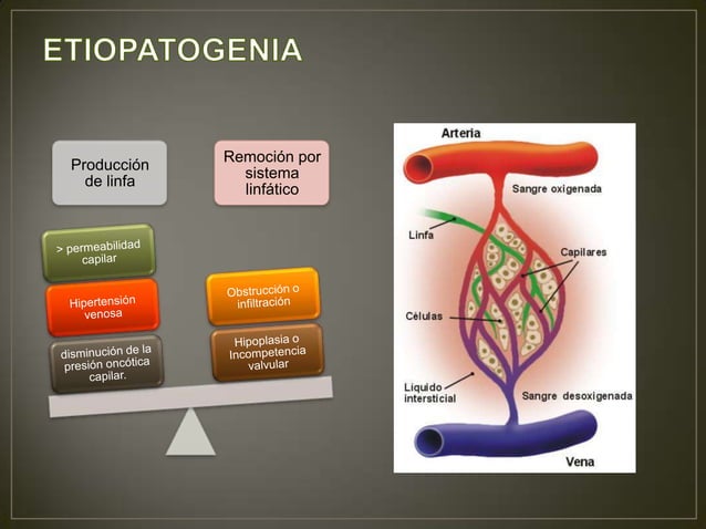 Linfangitis Reticular Lipedema, linfangitis, linfedema | PPTX
