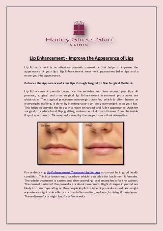 Lip Enhancement - Improve the Appearance of Lips 
Lip Enhancement is an effective cosmetic procedure that helps to improve the appearance of your lips. Lip Enhancement treatment guarantees fuller lips and a more youthful appearance. 
Enhance the Appearance of Your Lips through Surgical or Non Surgical Methods 
Lip Enhancement permits to reduce the wrinkles and lines around your lips. At present, surgical and non surgical lip Enhancement treatment procedures are obtainable. The surgical procedure overweight transfer, which is often known as overweight grafting, is done by injecting your own body overweight in to your lips. This helps to provide the lips with a more enhanced and fuller appearance. Another surgical procedure local flap grafting, makes use of skin and tissues from the inside flap of your mouth. This method is used by the surgeons as a final alternative. 
For undertaking Lip Enhancement Treatment in London, you must be in good health condition. This is a treatment procedure which is suitable for both men & females. The whole treatment is carried out after providing local anaesthesia for the patient. The normal period of the procedure is about two hours. Slight changes in period are likely to occur depending on the complexity & the type of procedure used. You might experience slight side effects such as inflammation, redness, bruising & numbness. These discomforts might last for a few weeks. 
 