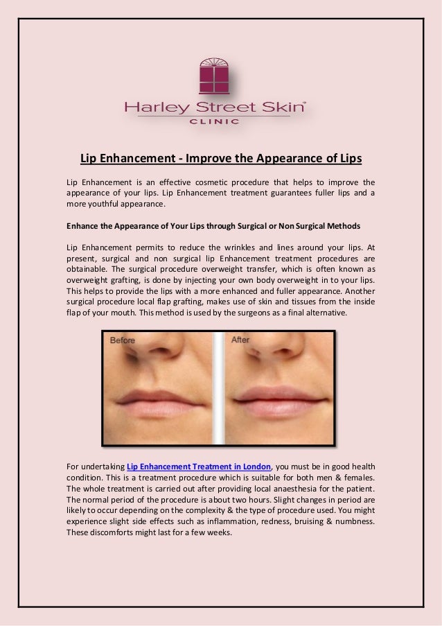 Lip enhancement improve the appearance of lips