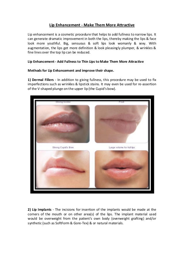 Lip Enhancement Make Them More Attractive