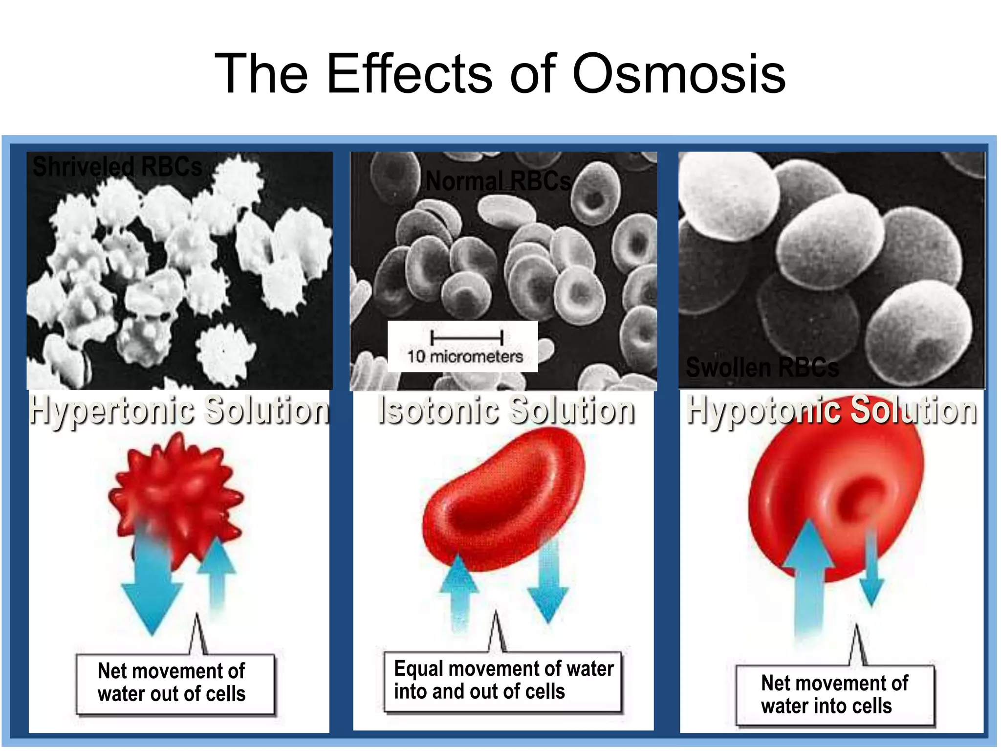Normal RBCs
Isotonic Solution
The Effects of Osmosis
Equal movement of water
into and out of cells
Net movement of
water out of cells Net movement of
water into cells
Shriveled RBCs
Swollen RBCs
Hypertonic Solution Hypotonic Solution
 