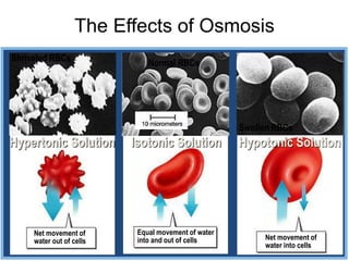 Normal RBCs
Isotonic Solution
The Effects of Osmosis
Equal movement of water
into and out of cells
Net movement of
water out of cells Net movement of
water into cells
Shriveled RBCs
Swollen RBCs
Hypertonic Solution Hypotonic Solution
 