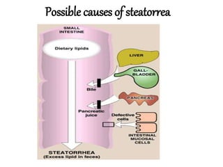 Possible causes of steatorrea
 
