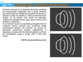 DOENÇAS:DOENÇAS: ANOREXIA NERVOSAANOREXIA NERVOSA
Anorexia nervosa é um distúrbio alimentar resultado
da preocupação exagerada com o peso corporal,
que pode provocar problemas psiquiátricos graves. A
pessoa se olha no espelho e, embora extremamente
magra, se vê obesa. Com medo de engordar,
exagera na atividade física, jejua, jejua, vomita, toma
laxantes e diuréticos.
É um transtorno que se manifesta principalmente em
mulheres jovens, embora sua incidência esteja
aumentando também em homens. Às vezes, os
pacientes anoréxicos chegam rapidamente à
caquexia, um grau extremo da desnutrição e o índice
de mortalidade chega a atingir 15% a 20% dos
casos.
FONTE: drauziovarella.ig.com.br
 