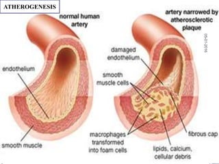 ATHEROGENESIS
05-01-2016
37
 
