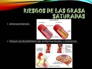 RIESGOS DE LAS GRASA
SATURADAS
• Ateroesclerosis.

• Mayor probabilidad de enfermedades cardiacas.

 