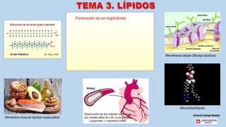 Antonio Campo Buetas
TEMA 3. LÍPIDOS
Alimentos ricos en lípidos insaturados
Obstrucción de las arterias coronarias
por niveles altos de LDL (Low Density
Lipoprotein = colesterol malo)
Membrana celular (Bicapa lipídica)
Glicerofosfolípido
 
