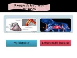 Riesgos de las grasas
saturadas

Aterosclerosis

Enfermedades cardíacas

 