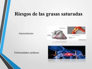 Riesgos de las grasas saturadas

Aterosclerosis

Enfermedades cardíacas

 