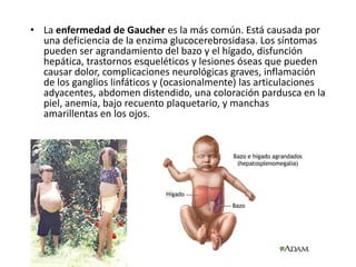 • La enfermedad de Gaucher es la más común. Está causada por
una deficiencia de la enzima glucocerebrosidasa. Los síntomas
pueden ser agrandamiento del bazo y el hígado, disfunción
hepática, trastornos esqueléticos y lesiones óseas que pueden
causar dolor, complicaciones neurológicas graves, inflamación
de los ganglios linfáticos y (ocasionalmente) las articulaciones
adyacentes, abdomen distendido, una coloración pardusca en la
piel, anemia, bajo recuento plaquetario, y manchas
amarillentas en los ojos.
 