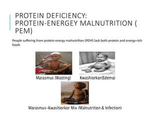 lipids and protein as energy yielding nutrients and macronutrients in ...
