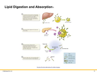 © McGraw Hill, LLC
Lipid Digestion and Absorption1
Access the text alternative for slide images.
56
 