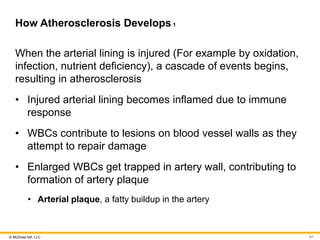 © McGraw Hill, LLC
How Atherosclerosis Develops 1
When the arterial lining is injured (For example by oxidation,
infection, nutrient deficiency), a cascade of events begins,
resulting in atherosclerosis
• Injured arterial lining becomes inflamed due to immune
response
• WBCs contribute to lesions on blood vessel walls as they
attempt to repair damage
• Enlarged WBCs get trapped in artery wall, contributing to
formation of artery plaque
• Arterial plaque, a fatty buildup in the artery
81
 