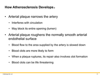 © McGraw Hill, LLC
How Atherosclerosis Develops 2
• Arterial plaque narrows the artery
• Interferes with circulation
• May block its entire opening (lumen)
• Arterial plaque roughens the normally smooth arterial
endothelial surface
• Blood flow to the area supplied by the artery is slowed down
• Blood clots are more likely to form
• When a plaque ruptures, its repair also involves clot formation
• Blood clots can be life threatening
82
 