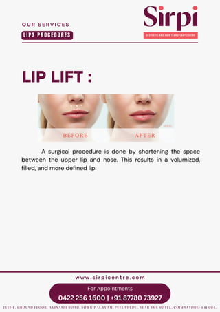 For Appointments
0422 256 1600 | +91 87780 73927
LIP LIFT :
A surgical procedure is done by shortening the space
between the upper lip and nose. This results in a volumized,
filled, and more defined lip.
O U R S E R V I C E S
1 3 3 5 - F , G R O U N D F L O O R , A V I N A S H I R O A D , S O W R I P A L A Y A M , P E E L A M E D U , N E A R S M S H O T E L , C O I M B A T O R E - 6 4 1 0 0 4 .
w w w . s i r p i c e n t r e . c o m
L I P S P R O C E D U R E S
 