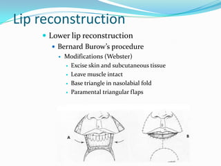 Lip n cheek recons | PPTX