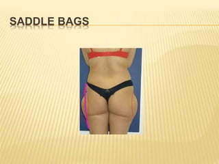 SADDLE BAGS 
 