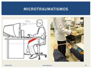 MICROTRAUMATISMOS
jhauva@achs.cl22-05-2013 16
 