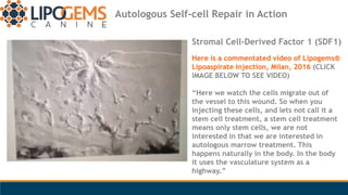 Stromal Cell-Derived Factor 1 (SDF1)
Here is a commentated video of Lipogems®
Lipoaspirate injection, Milan, 2016 (CLICK
I...
