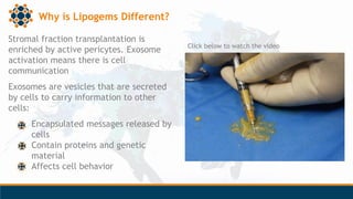 Why is Lipogems Different?
Stromal fraction transplantation is
enriched by active pericytes. Exosome
activation means ther...