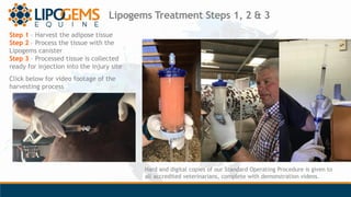 Lipogems Treatment Steps 1, 2 & 3
Step 1 – Harvest the adipose tissue
Step 2 – Process the tissue with the
Lipogems canist...