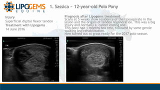 1. Sassica ~ 12-year-old Polo Pony
Injury
Superficial digital flexor tendon
Treatment with Lipogems
14 June 2016
Prognosis...