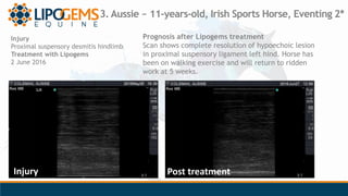 3. Aussie ~ 11-years-old, Irish Sports Horse, Eventing 2*
Prognosis after Lipogems treatment
Scan shows complete resolutio...