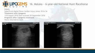 16. Maluka ~ 6-year-old National Hunt Racehorse
Injury
Superficial digital flexor tendon injury zones 1B to 3A
Treatment w...