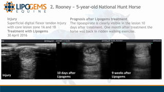 2. Rooney ~ 5-year-old National Hunt Horse
Injury
Superficial digital flexor tendon injury
with core lesion zone 1A and 1B...
