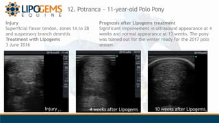 12. Potranca ~ 11-year-old Polo Pony
Injury
Superficial flexor tendon, zones 1A to 2B
and suspensory branch desmitis
Treat...