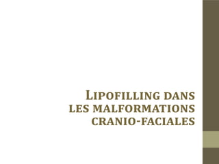 Séquelles de traumatisme facial avec enfoncement osseux en
sus-orbitaire droit.
 
