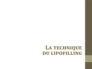 Histoire du lipofilling
La greffe du tissu graisseux a été rapportée dés la fin du 19iéme siècle.
On peut distinguer trois périodes importantes dans l’évolution du lipofil-
ling.
„„La période de greffe à ciel ouvert:
L’excision et le remplissage se faisaient à ciel ouvert.
„„La période non purifiée:
La graisse est aspirée par lipoaspiration et réinjectée .
„„La période purifiée:
La graisse est purifiée avant sa réinjection.
„„ Avenir du lipofilling
L’ingénierie tissulaire offre des perspectives prometteuses pour le lipofilling
grâce à une meilleure connaissance du développement des adipocytes.
 