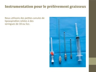 Sites de prélèvement
„„L’abdomen.
La graisse abdominale se résorbe peu et s’hypertrophie facilement avec
une prise de poids même minime.
„„La région trochanterienne.
S’il ya lieu de pratiquer une liposuccion.
„„La face interne des genoux .
la graisse est facile à prélever et ne s’hypertrophie pas facilement . Ce site
est notre premier choix.
Même en absence de zones graisseuses localisées, il est toujours possible
de prélever de la graisse au niveau des fesses.
 