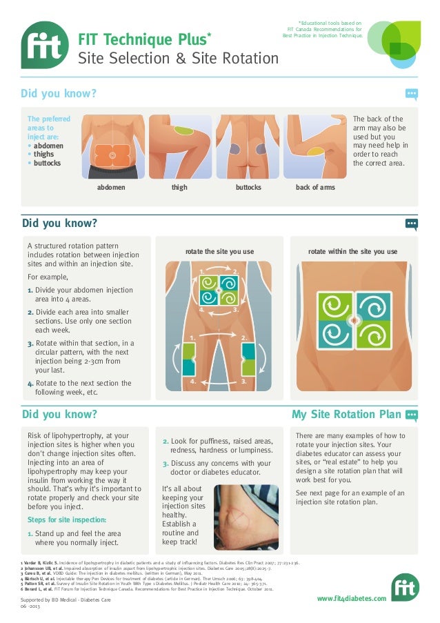 ipo example chart & Care Diabetes Lipohypertrophy Injection Community ipo example chart & Care Diabetes Lipohypertrophy Injection Community