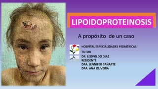 LIPOIDOPROTEINOSIS
HOSPITAL ESPECIALIDADES PEDIÁTRICAS
TUTOR
DR. LEOPOLDO DIAZ
RESIDENTE
DRA. JENNIFER CAÑARTE
DRA. ANA OLIVEIRA
A propósito de un caso
 