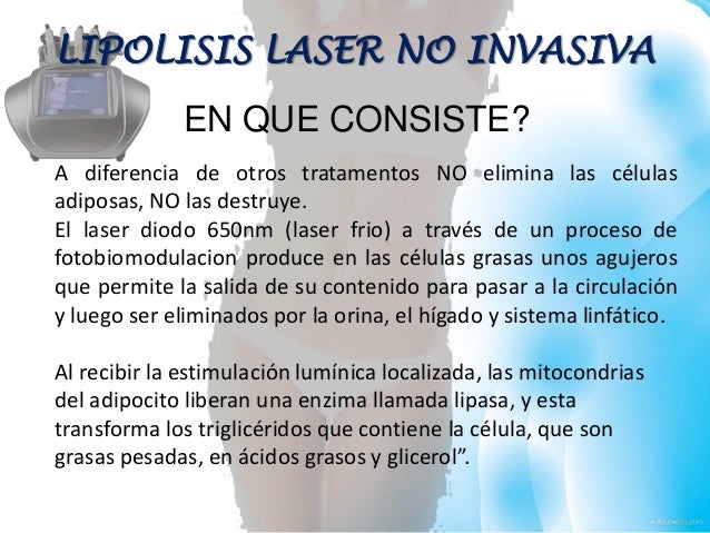 Lipolisis laser Lipolisis laser