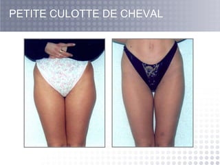 PETITE CULOTTE DE CHEVAL 