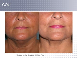 COU Courtesy of Cheryl Karcher, MD New York   