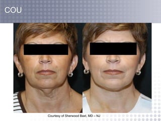 Courtesy of Sherwood Baxt, MD – NJ  COU 