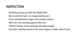 INSPECTION
-Swelling moving up with the Deglutition .
-No movement seen on tongue protrusion .
-It has well defined margin and smooth surface .
-Skin over the swelling appears Normal .
-Inferior border of the swelling well appreciated.
-No other swelling noted in the same region or both side of neck .
 